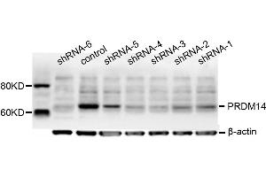 Dot Blot (DB) image for anti-PR Domain Containing 14 (PRDM14) antibody (ABIN1876766) (PRDM14 antibody)