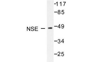 Image no. 1 for anti-Enolase 2 (Gamma, Neuronal) (ENO2) antibody (ABIN271752) (ENO2/NSE antibody)