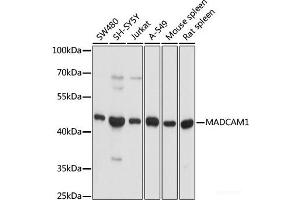 Western blot analysis of extracts of various cell lines using MADCAM1 Polyclonal Antibody at dilution of 1:1000. (MADCAM1 antibody)