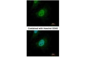 ICC/IF Image Immunofluorescence analysis of paraformaldehyde-fixed HeLa, using SMAD9, antibody at 1:500 dilution.