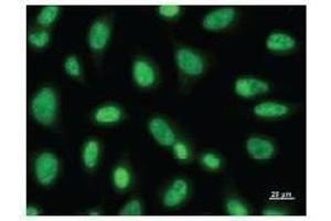 Immunostaining analysis in HeLa cells. (PAX6 antibody)