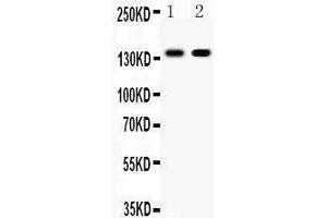 Observed bind size: 140KD (E-cadherin antibody  (AA 286-703))