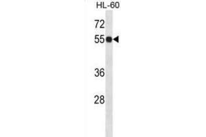 Western Blotting (WB) image for anti-Inosine 5'-Phosphate Dehydrogenase 1 (IMPDH1) antibody (ABIN2998164)