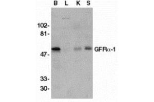 Western blot analysis of GFR alpha 1 in crude membrane fractions of human brain (B), liver (L), kidney (K), and spleen (S), respectively, with AP30361PU-N GFR alpha 1 antibody at 1/500 dilution. (GFRA1 antibody  (Intermediate Domain))