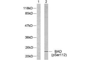 Western blot analysis of extracts from 293 cells using BAD (phospho-Ser112) antibody (E011067). (BAD antibody  (pSer112))