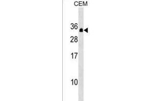 PDCD10 Antibody (Center) (ABIN1538712 and ABIN2849495) western blot analysis in CEM cell line lysates (35 μg/lane). (PDCD10 antibody  (AA 96-124))