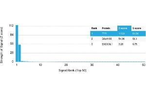 Analysis of Protein Array containing more than 19,000 full-length human proteins using Transthyretin (Prealbumin) Mouse Monoclonal Antibody (CPTC-TTR-1). (TTR antibody)