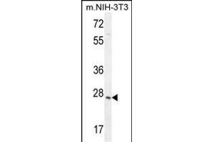 ZCCHC17 Antibody (Center) (ABIN654970 and ABIN2844608) western blot analysis in mouse NIH-3T3 cell line lysates (35 μg/lane). (ZCCHC17 antibody  (AA 159-187))