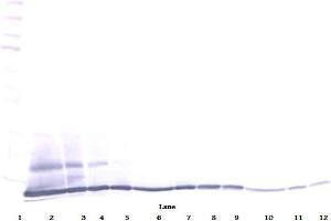 Western Blot (Reduced) using ESkine / CCL27 antibody (CCL27 antibody)