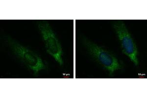 ICC/IF Image CYP7B1 antibody [C3], C-term detects CYP7B1 protein at cytoplasm by immunofluorescent analysis. (CYP7B1 antibody  (C-Term))