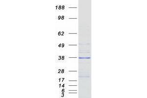 VPS37B Protein (Myc-DYKDDDDK Tag)