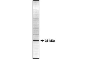 Image no. 1 for anti-Protein Phosphatase 1, Catalytic Subunit, gamma Isoform (PPP1CC) (Isoform gamma 2) antibody (ABIN264937) (PPP1CC antibody  (Isoform gamma 2))
