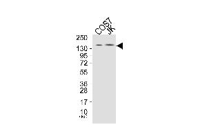 Western blot analysis of extracts from COS7 cells (Lane 1), and JK cells (Lane 2), using PLCG1 (Ab-771) Antibody. (Phospholipase C gamma 1 antibody)