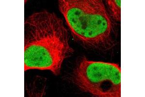 Immunofluorescent staining of U-2 OS with MCM6 polyclonal antibody  (Green) shows positivity in nucleus but excluded from the nucleoli.