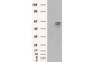 Image no. 2 for anti-Pantothenate Kinase 2 (PANK2) antibody (ABIN1500026) (PANK2 antibody)