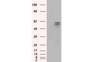 Image no. 2 for anti-Pantothenate Kinase 2 (PANK2) antibody (ABIN1500026) (PANK2 antibody)
