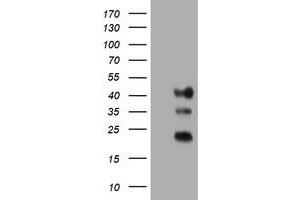 Image no. 1 for anti-Transmembrane Protein 173 (TMEM173) antibody (ABIN1501425) (STING/TMEM173 antibody)