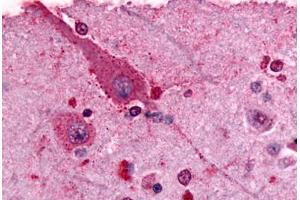 Anti-GRM2 / MGLUR2 antibody  ABIN1048930 IHC staining of human brain, neurons and glia.