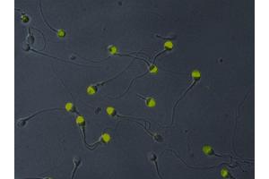 Immunofluorescence analysis of VCP in acetone-permeabilized human sperms using monoclonal antibody Hs-14 demonstrates its location to the acrosome. (VCP antibody)