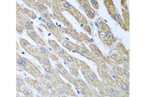 Immunohistochemistry of paraffin-embedded Human liver using FUT6 Polyclonal Antibody at dilution of 1:100 (40x lens). (FUT6 antibody)