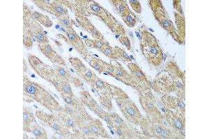 Immunohistochemistry of paraffin-embedded Human liver using FUT6 Polyclonal Antibody at dilution of 1:100 (40x lens).
