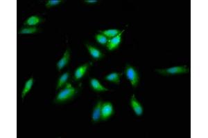 Immunofluorescence staining of Hela cells with ABIN7170782 at 1:66, counter-stained with DAPI.