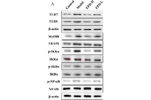 EPD suppressed the activation of the Toll-like receptor 7-myeloid differentiation primary response gene 88-nuclear factor-κB (TLR7/8-MyD88-NF-κB) signaling pathways. (NFKBIA antibody  (AA 1-120))