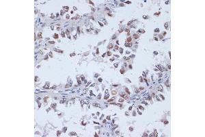 Immunohistochemistry (IHC) image for anti-DNA (Cytosine-5-)-Methyltransferase 3 Like (TRDMT1) (AA 1-386) antibody (ABIN3023229)
