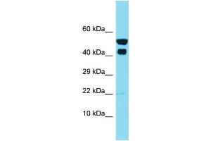 Western Blotting (WB) image for anti-Inhibitor of KB Kinase beta Interacting Protein (IKbIP) (N-Term) antibody (ABIN2791586)