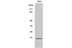 Western Blotting (WB) image for anti-Superoxide Dismutase 1, Soluble (SOD1) antibody (ABIN5958576) (SOD1 antibody)
