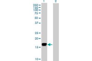Western Blot analysis of IFNA2 expression in transfected 293T cell line by IFNA2 MaxPab polyclonal antibody. (IFNA2 antibody  (AA 1-188))