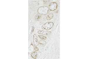 Immunohistochemistry (IHC) image for anti-Torsin A Interacting Protein 1 (TOR1AIP1) (AA 275-325) antibody (ABIN7448627) (TOR1AIP1 antibody  (AA 275-325))
