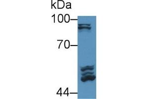 Detection of POSTN in Rat Serum using Polyclonal Antibody to Periostin (POSTN) (Periostin antibody  (AA 24-173))