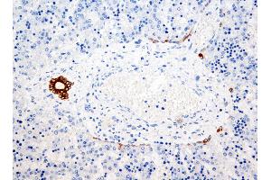 Immunohistochemistry (IHC) image for anti-Keratin 7/17/19 (KRT7/17/19) antibody (ABIN108432) (Keratin 7/17/19 antibody)