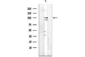 Western blot analysis of lysates from HUVEC cells(heat-shock treatment), using Retinoblastoma Mouse Monoclonal Antibody.