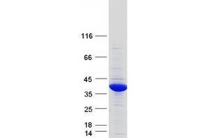 Glycerol-3-Phosphate Dehydrogenase 1-Like (GPD1L) protein (Myc-DYKDDDDK Tag)