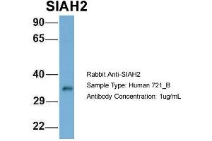 Host: Rabbit Target Name: SIAH2 Sample Type: 721_B Antibody Dilution: 1.