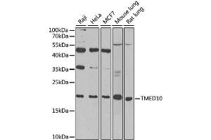 Western blot analysis of extracts of various cell lines, using TMED10 antibody. (TMED10 antibody)