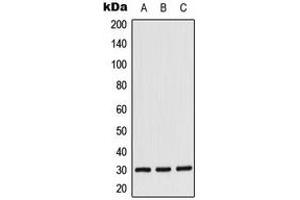 Western blot analysis of CK1 alpha expression in Jurkat (A), K562 (B), NIH3T3 (C) whole cell lysates. (CSNK1A1 antibody  (Center))