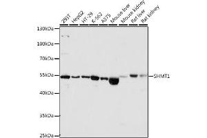 Western blot analysis of extracts of Mouse liver, using SHMT1 antibody (ABIN6132654, ABIN6147744, ABIN6147746 and ABIN6216135) at 1:1560 dilution. (SHMT1 antibody  (AA 285-444))