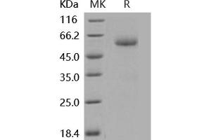Western Blotting (WB) image for Bone Morphogenetic Protein Receptor 1A (BMPR1A) (Active) protein (His tag,Fc Tag) (ABIN7320450) (BMPR1A Protein (His tag,Fc Tag))