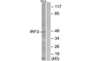 Western blot analysis of extracts from HeLa cells, using IRF3 (Ab-396) Antibody. (IRF3 antibody  (AA 362-411))