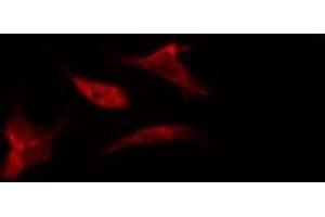 ABIN6276034 staining LOVO by IF/ICC. (GPR34 antibody  (C-Term))
