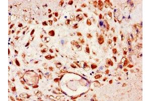 Immunohistochemistry of paraffin-embedded human placenta tissue using ABIN7151436 at dilution of 1:100 (FBLN4 antibody  (AA 26-165))