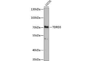 Western blot analysis of extracts of U2OS cells, using TDRD3 antibody (ABIN6133097, ABIN6148978, ABIN6148979 and ABIN6221657) at 1:1000 dilution. (TDRD3 antibody  (AA 1-220))