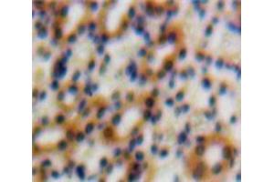IHC-P analysis of Kidney tissue, with DAB staining. (TGFB1I1 antibody  (AA 252-390))