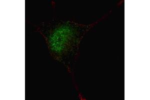 Fluorescent confocal image of SY5Y cells stained with phospho-STAT3- antibody.
