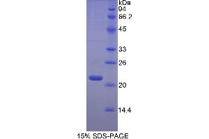 SDS-PAGE (SDS) image for Hemoglobin beta (HBB) (AA 1-147) protein (His tag) (ABIN2123835) (Hemoglobin Subunit beta Protein (AA 1-147) (His tag))