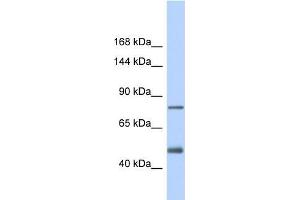 Host:  Rabbit  Target Name:  LDLR  Sample Type:  Fetal Heart lysates  Antibody Dilution:  1. (LDLR antibody  (C-Term))