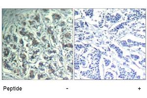 Image no. 1 for anti-phospholipase C, gamma 1 (PLCG1) (Tyr771) antibody (ABIN319399)